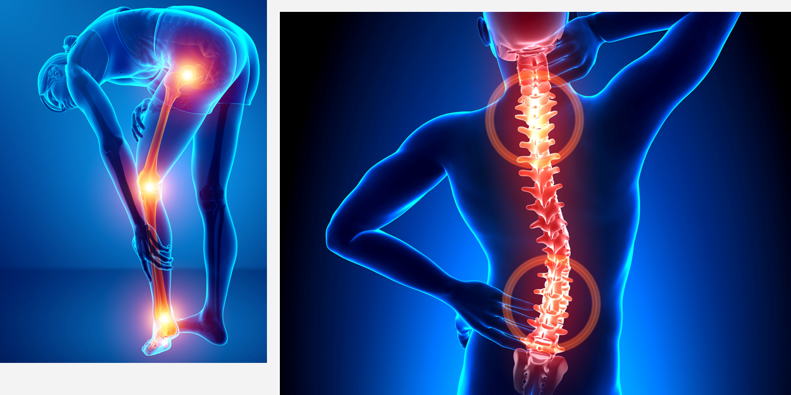 Spine and leg joint pain zones, illustration of affected areas